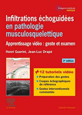 Infiltrations &eacute;choguid&eacute;es en pathologie musculosquelettique