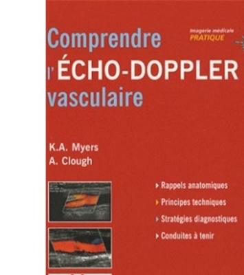 Fournisseur Cultura Comprendre L'&eacute;cho-doppler Vasculaire