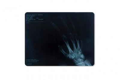 TOTALCADEAU Tapis de souris informatique radiographie main